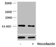 Western blot analysis of extracts from Hela cells, untreated (-) or treated, 1:5000.