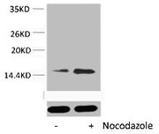 Western blot analysis of extracts from Hela cells, untreated (-) or treated, 1:5000.