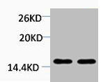Western blot analysis of 1) Hela, 2) 3T3, diluted at 1:2000.