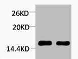 Western blot analysis of 1) Hela, 2) 3T3, diluted at 1:2000.