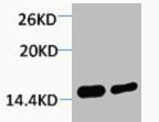 Western blot analysis of 1) Hela, 2) 3T3, diluted at 1:2000.