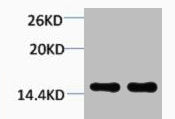Western blot analysis of 1) Hela, 2) 3T3, diluted at 1:2000.