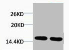 Western blot analysis of 1) Hela, 2) 3T3, diluted at 1:2000.