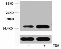 Western blot analysis of extracts from Hela cells, untreated (-) or treated, 1:2000.