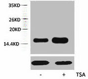 Western blot analysis of extracts from Hela cells, untreated (-) or treated, 1:5000.