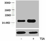 Western blot analysis of extracts from Hela cells, untreated (-) or treated, 1:5000.