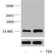 Western blot analysis of extracts from Hela cells, untreated (-) or treated, 1:5000.