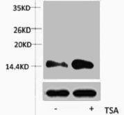 Western blot analysis of extracts from Hela cells, untreated (-) or treated, 1:5000.