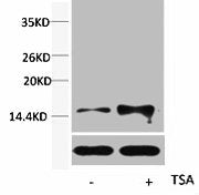 Western blot analysis of extracts from Hela cells, untreated (-) or treated, 1:5000.