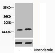 Western blot analysis of extracts from Hela cells, untreated (-) or treated, 1:5000.