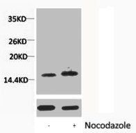 Western blot analysis of extracts from Hela cells, untreated (-) or treated, 1:5000.