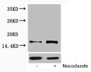 Western blot analysis of extracts from Hela cells, untreated (-) or treated, 1:5000.