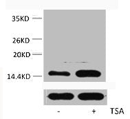 Western blot analysis of extracts from Hela cells, untreated (-) or treated, 1:5000.