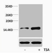 Western blot analysis of extracts from Hela cells, untreated (-) or treated, 1:5000.