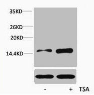 Western blot analysis of extracts from Hela cells, untreated (-) or treated, 1:5000.