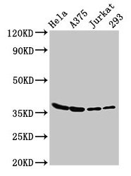 Western Blot Positive WB detected in: Hela whole cell lysate, A375 whole cell lysate, Jurkat whole cell lysate, 293 whole cell lysate All lanes: LDHA antibody at 3µg/ml Secondary Goat polyclonal to rabbit IgG at 1/50000 dilution Predicted band siz...