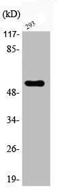 Western Blot analysis of 293 cells using Phospho-Akt2 (S474) Polyclonal Antibody