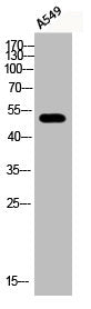 Western Blot analysis of A549 cells using Phospho-ATF-2 (S112) Polyclonal Antibody