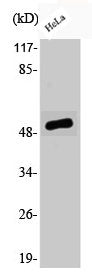 Western Blot analysis of HeLa cells using Phospho-ATF-2 (S62) Polyclonal Antibody