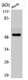 Western Blot analysis of HuvEc cells using Phospho-ATF-2 (T71) Polyclonal Antibody