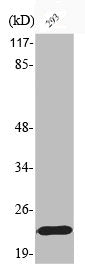 Western Blot analysis of 293 cells using Phospho-Bad (S155) Polyclonal Antibody
