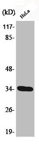 Western Blot analysis of HeLa cells using Phospho-Cdk2 (T160) Polyclonal Antibody