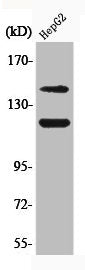 Western Blot analysis of HepG2 cells using Phospho-c-Kit (Y721) Polyclonal Antibody