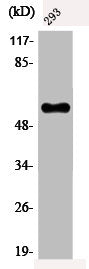 Western Blot analysis of 293 cells using Phospho-c-Myc (T58) Polyclonal Antibody