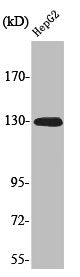 Western Blot analysis of HepG2 cells using Phospho-EphA2 (Y588) Polyclonal Antibody