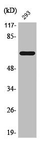 Western Blot analysis of 293 cells using Phospho-ERα (S104) Polyclonal Antibody