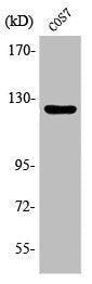 Western Blot analysis of Jurkat cells using Phospho-FAK (Y861) Polyclonal Antibody