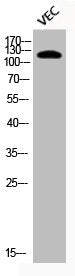 Western Blot analysis of VEC cells using Phospho-HDAC5 (S498) Polyclonal Antibody