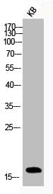 Western Blot analysis of KB cells using Phospho-Histone H3 (S10) Polyclonal Antibody