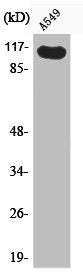 Western Blot analysis of A549 cells using Phospho-Hrs (Y216) Polyclonal Antibody