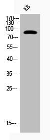 Western Blot analysis of KB cells using Phospho-IKKα (T23) Polyclonal Antibody