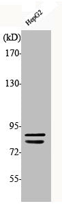 Western Blot analysis of HepG2 cells using Phospho-IKKα/β (S180/181) Polyclonal Antibody
