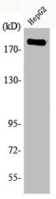 Western Blot analysis of HepG2 cells using Phospho-IRS-1 (S1101) Polyclonal Antibody