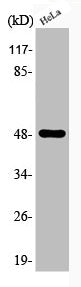 Western Blot analysis of HeLa cells using Phospho-IκB-β (S23) Polyclonal Antibody