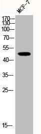 Western Blot analysis of MCF-7 cells using Phospho-JNK1/2/3 (T183) Polyclonal Antibody