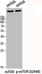 Western Blot analysis of HY926 cells using Phospho-mTOR (S2448) Polyclonal Antibody