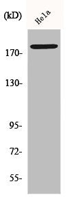 Western Blot analysis of HepG2 cells using Phospho-Neu (Y877) Polyclonal Antibody