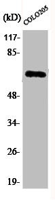 Western Blot analysis of COLO205 cells using Phospho-NFκ;B-p65 (S536) Polyclonal Antibody