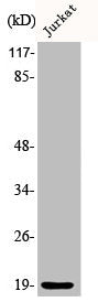 Western Blot analysis of Jurkat cells using Phospho-Op18 (S25) Polyclonal Antibody