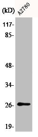 Western Blot analysis of COLO205 cells using Phospho-p27 (S10) Polyclonal Antibody