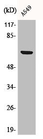 Western Blot analysis of A549 cells using Phospho-p70 S6 kinase α (S447) Polyclonal Antibody