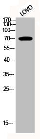 Western Blot analysis of LOVO cells using Phospho-p70 S6 kinase α (T229) Polyclonal Antibody
