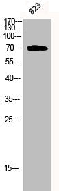 Western Blot analysis of 823 cells using Phospho-PKC ζ (T410) Polyclonal Antibody