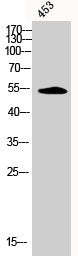 Western Blot analysis of 453 cells using Phospho-CaMKIIα/β/δ (T305) Polyclonal Antibody