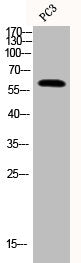 Western Blot analysis of PC-3 cells using Phospho-PPAR-γ (S112) Polyclonal Antibody