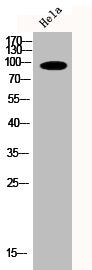 Western Blot analysis of HELA cells using Phospho-PKD2 (S876) Polyclonal Antibody